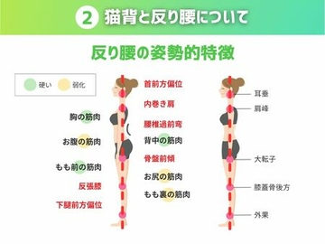 2 猫背と反り腰について