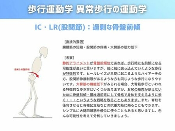 歩行運動学 異常歩行の運動学編