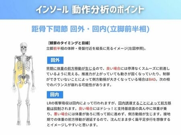 インソール 動作分析のポイント編